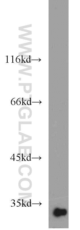 Western Blot (WB) analysis of mouse kidney tissue using CHMP1A Polyclonal antibody (15761-1-AP)