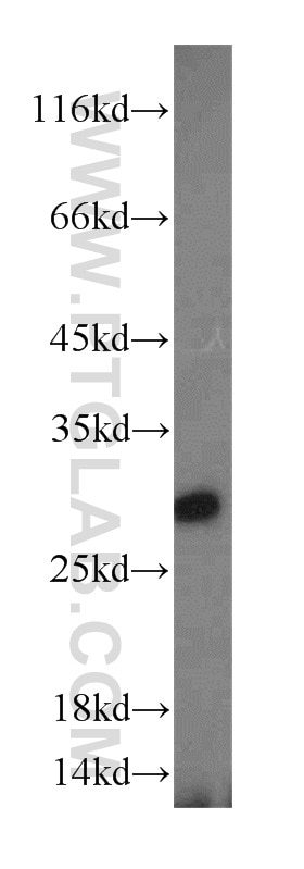 Western Blot (WB) analysis of A431 cells using CHMP1A Polyclonal antibody (15761-1-AP)