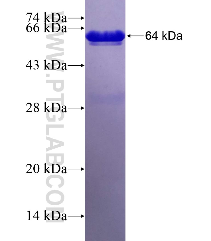 CHMP1A fusion protein Ag8389 SDS-PAGE
