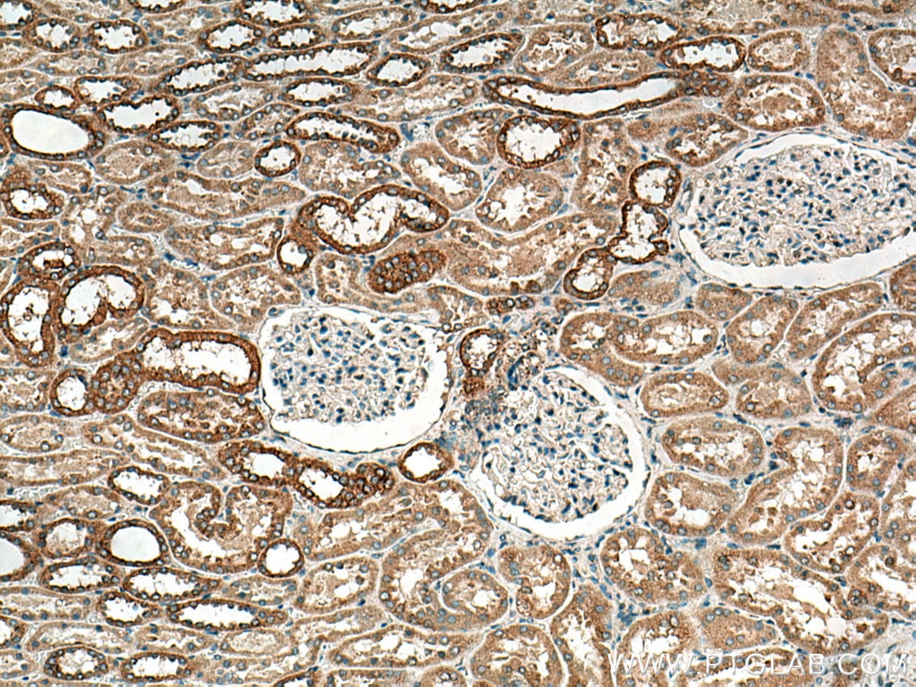 IHC staining of human kidney using 14639-1-AP