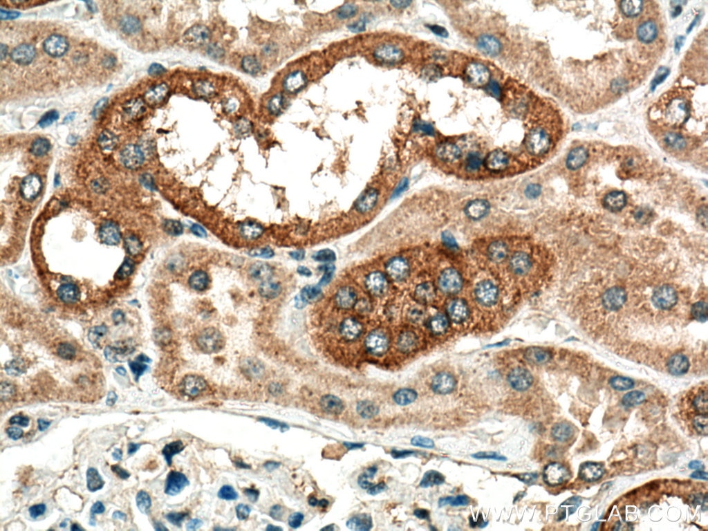 Immunohistochemistry (IHC) staining of human kidney tissue using CHMP1B Polyclonal antibody (14639-1-AP)