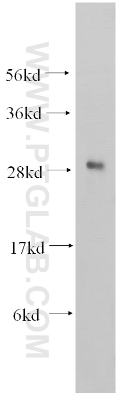 CHMP1B Polyclonal antibody