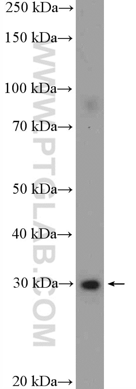 Western Blot (WB) analysis of HeLa cells using CHMP2A Polyclonal antibody (10477-1-AP)