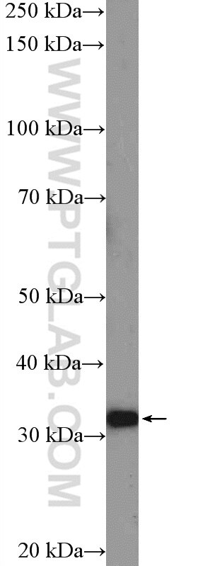 CHMP2A