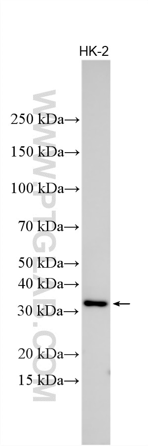 Various lysates were subjected to SDS PAGE followed by western blot with 10477-1-AP (CHMP2A antibody) at dilution of 1:2500 incubated at room temperature for 1.5 hours. Western Blot (WB) analysis of various lysates using CHMP2A Polyclonal antibody (10477-1-AP)