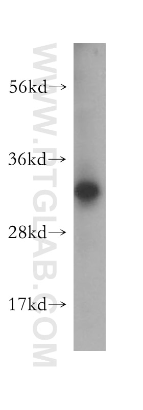 Western Blot (WB) analysis of HEK-293 cells using CHMP2A Polyclonal antibody (10477-1-AP)