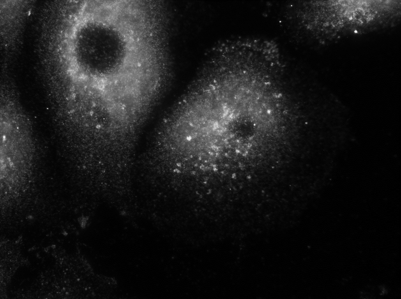 IF Staining of PFA fixed cells using 12527-1-AP