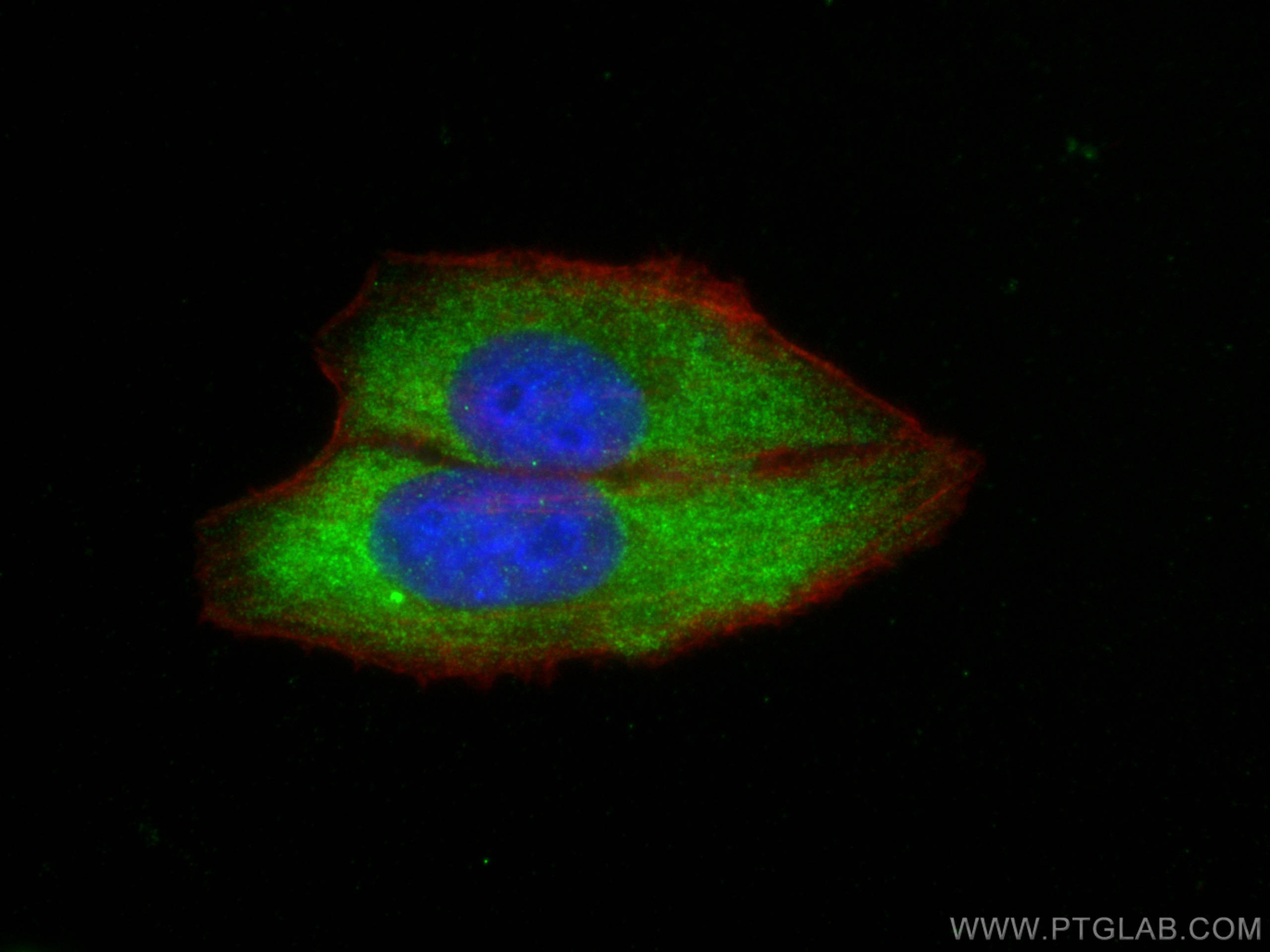 Immunofluorescence (IF) / fluorescent staining of HepG2 cells using CHMP2B Polyclonal antibody (12527-1-AP)