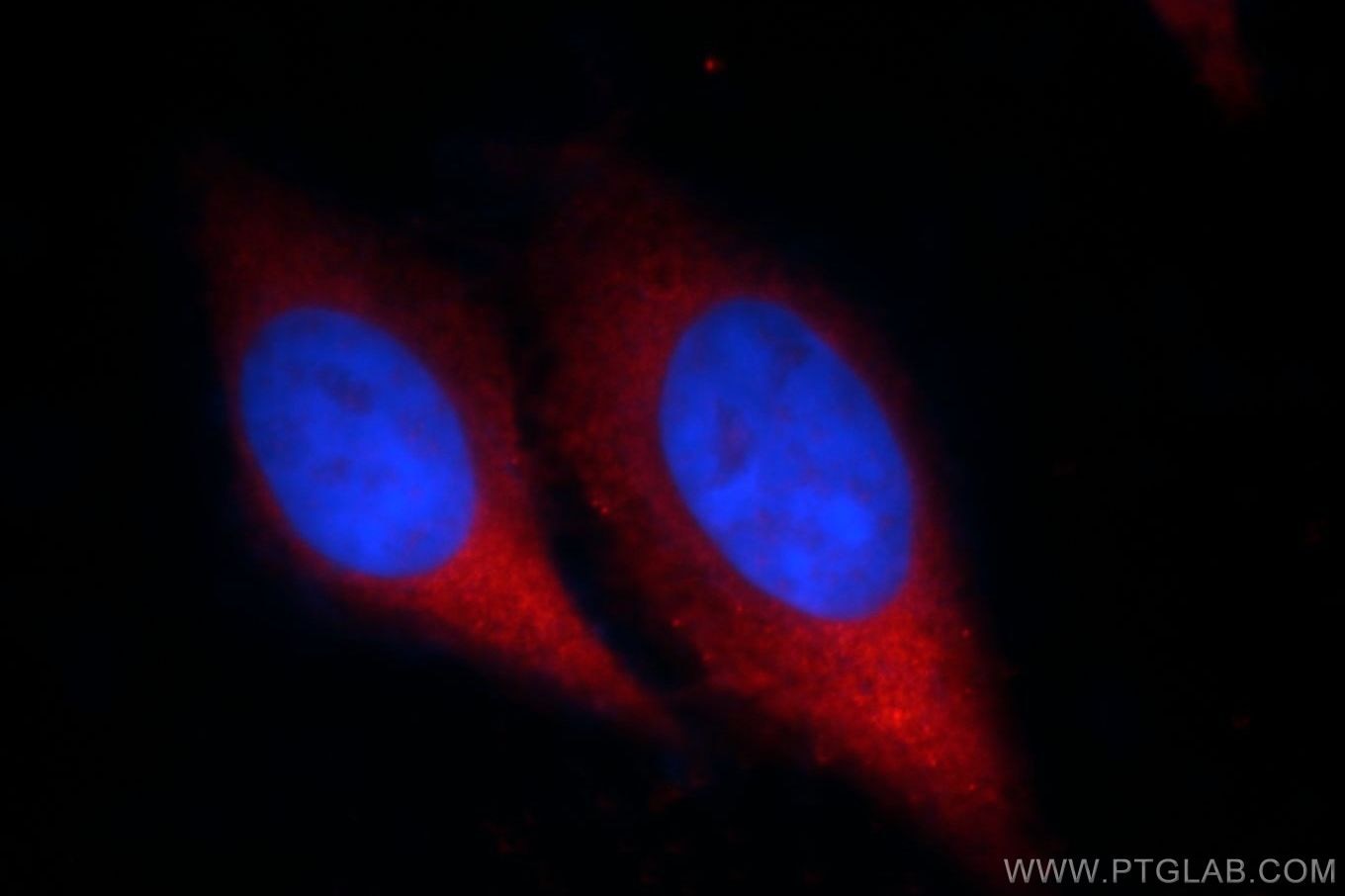 Immunofluorescence (IF) / fluorescent staining of HepG2 cells using CHMP2B Polyclonal antibody (12527-1-AP)