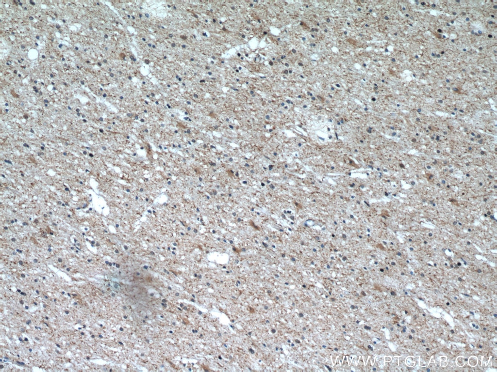 Immunohistochemistry (IHC) staining of human brain tissue using CHMP2B Polyclonal antibody (12527-1-AP)