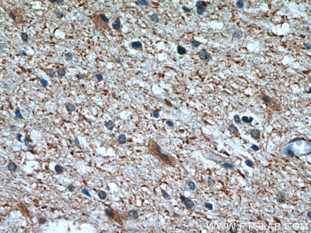 Immunohistochemistry (IHC) staining of human brain tissue using CHMP2B Polyclonal antibody (12527-1-AP)