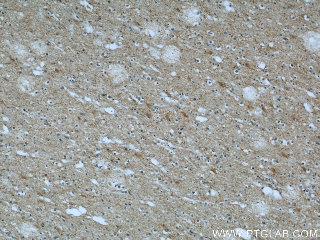 Immunohistochemistry (IHC) staining of human brain tissue using CHMP2B Polyclonal antibody (12527-1-AP)