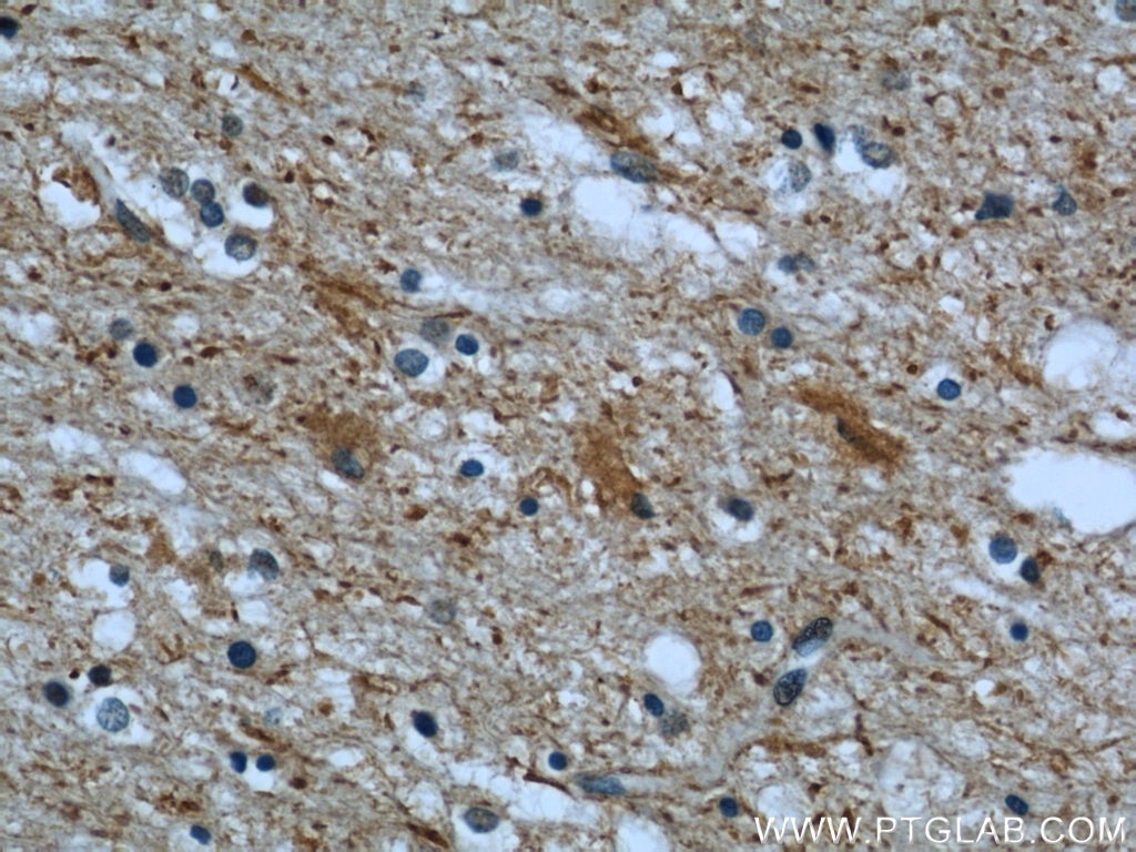 Immunohistochemistry (IHC) staining of human brain tissue using CHMP2B Polyclonal antibody (12527-1-AP)