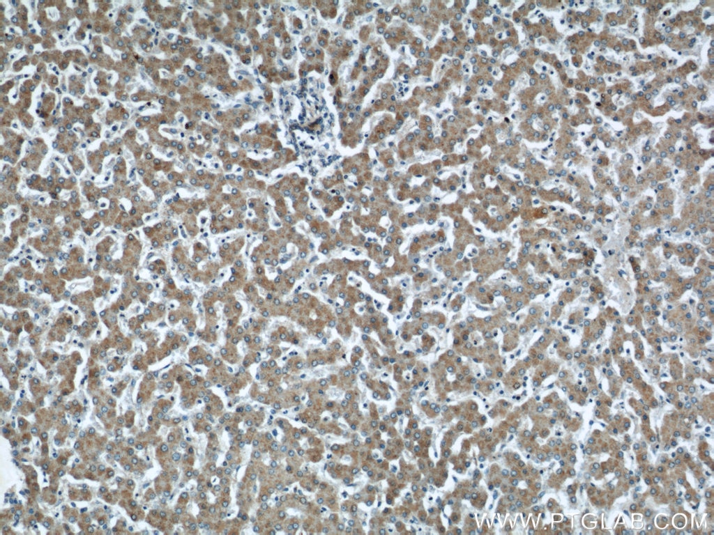 Immunohistochemistry (IHC) staining of human liver tissue using CHMP2B Polyclonal antibody (12527-1-AP)