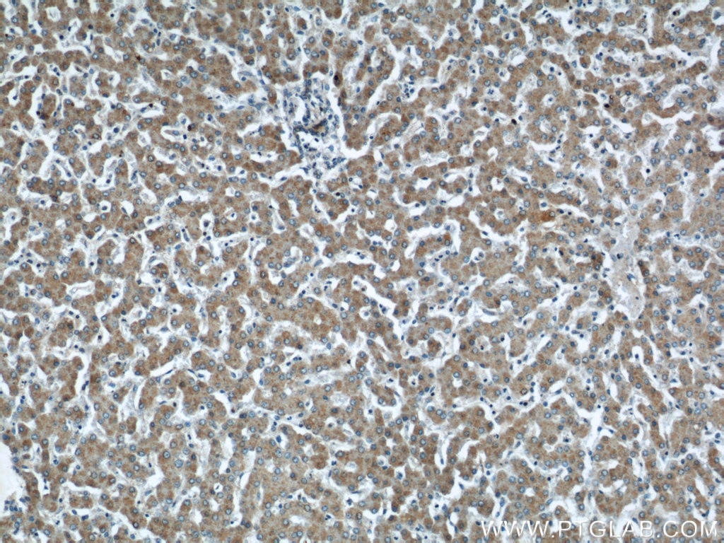 IHC staining of human liver using 12527-1-AP