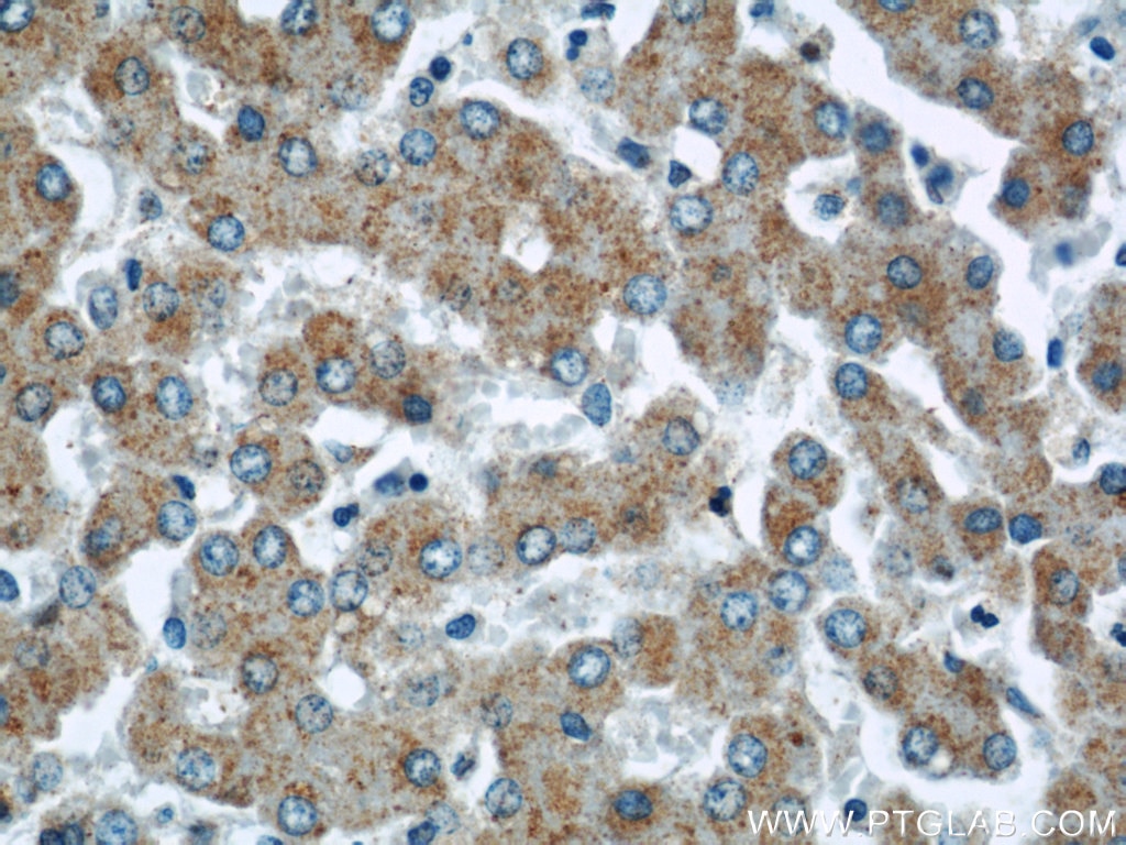 Immunohistochemistry (IHC) staining of human liver tissue using CHMP2B Polyclonal antibody (12527-1-AP)