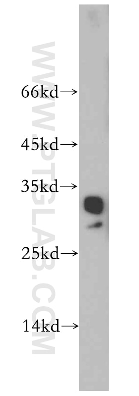 Western Blot (WB) analysis of human heart tissue using CHMP2B Polyclonal antibody (12527-1-AP)