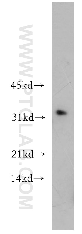 Western Blot (WB) analysis of human ileum tissue using CHMP2B Polyclonal antibody (12527-1-AP)