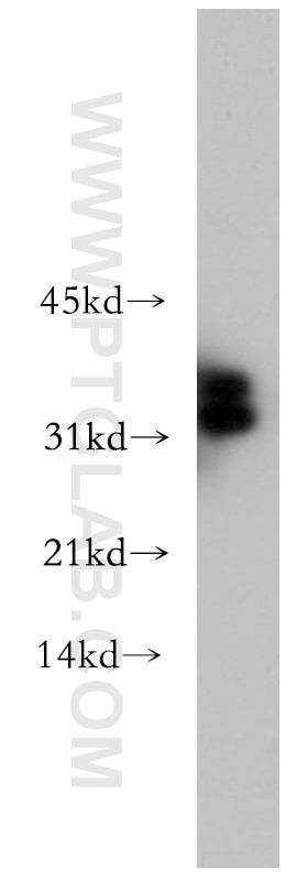 Western Blot (WB) analysis of human kidney tissue using CHMP2B Polyclonal antibody (12527-1-AP)