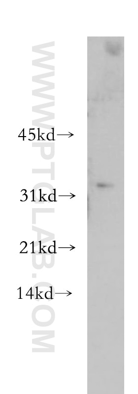 Western Blot (WB) analysis of human placenta tissue using CHMP2B Polyclonal antibody (12527-1-AP)