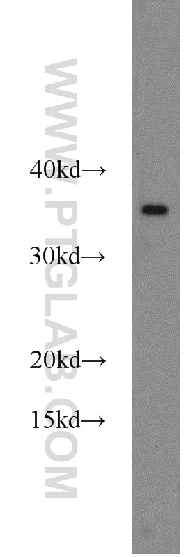 Western Blot (WB) analysis of mouse brain tissue using CHMP2B Polyclonal antibody (12527-1-AP)