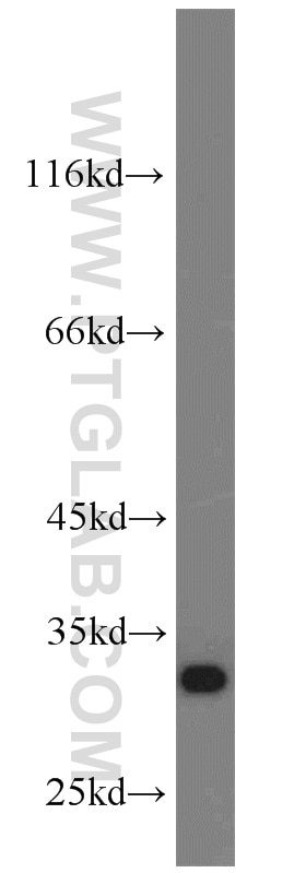 Western Blot (WB) analysis of SH-SY5Y cells using CHMP2B Polyclonal antibody (12527-1-AP)