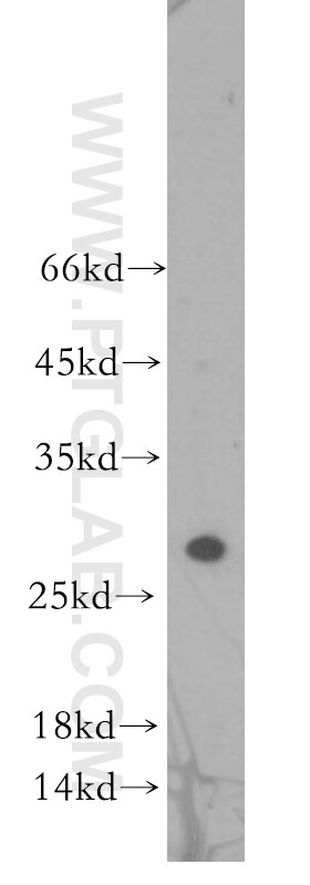 Western Blot (WB) analysis of human brain tissue using CHMP2B Polyclonal antibody (12527-1-AP)