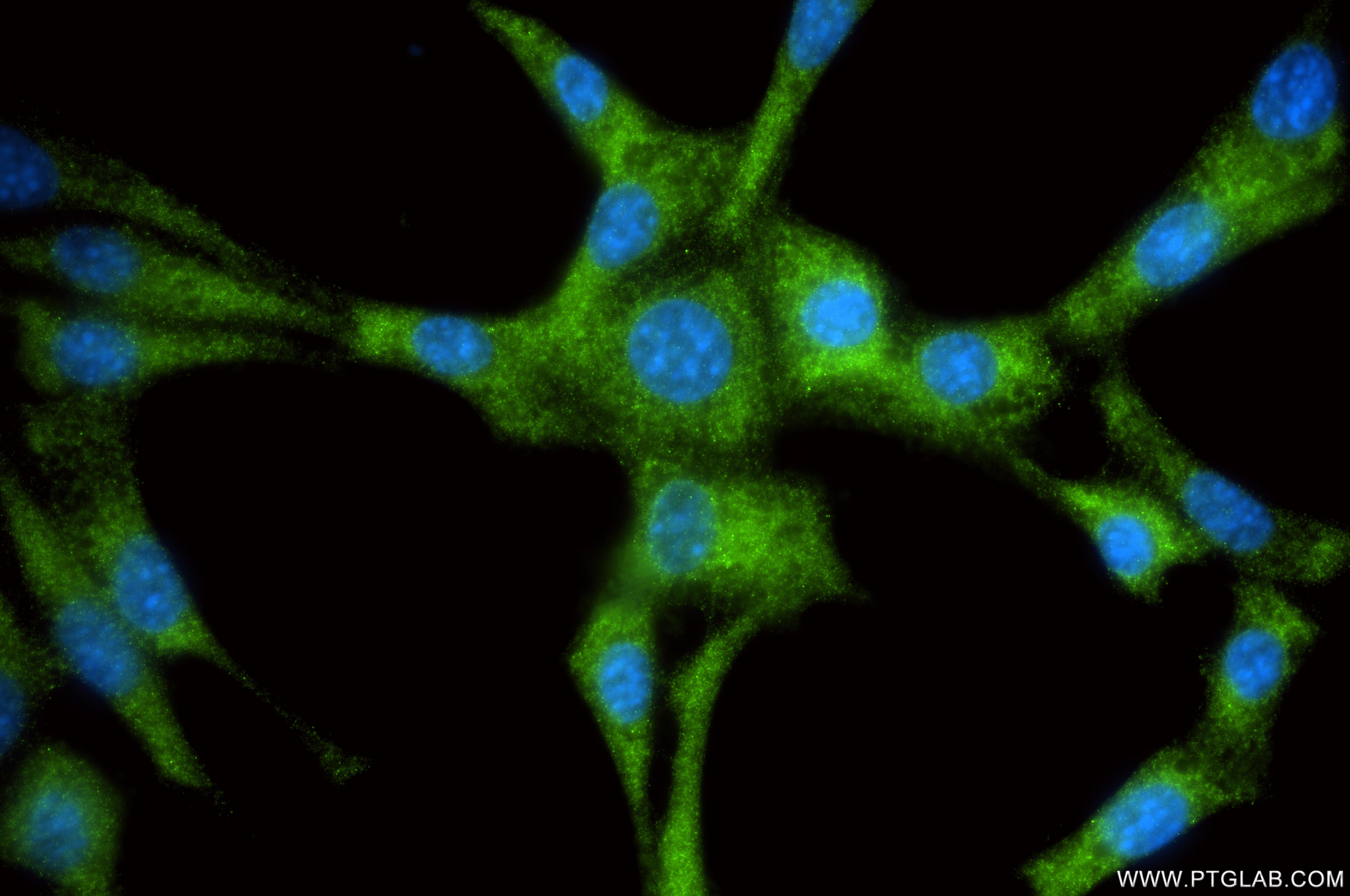 Immunofluorescence (IF) / fluorescent staining of NIH/3T3 cells using CHMP2B Recombinant monoclonal antibody (87151-1-RR)