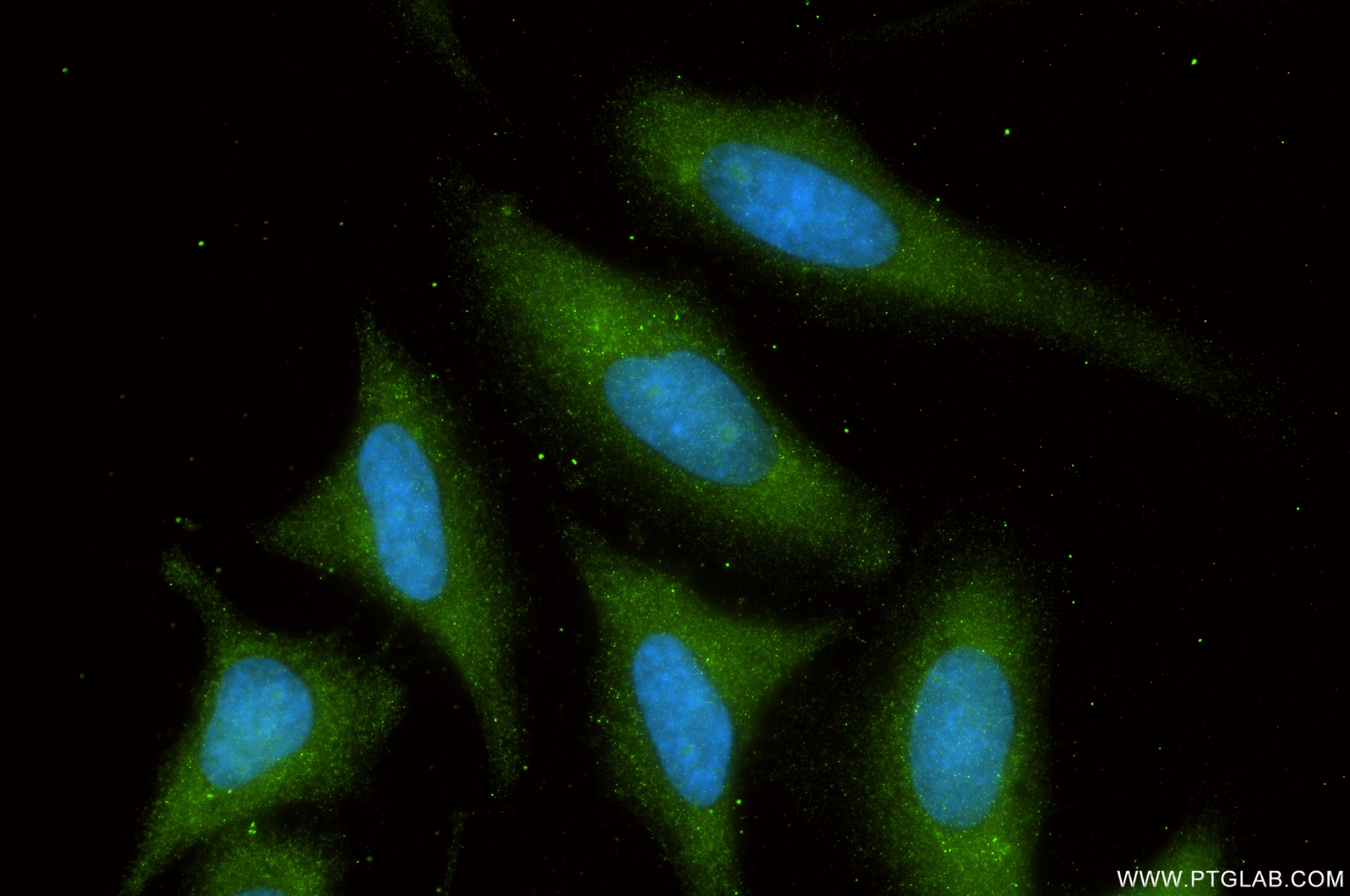 Immunofluorescence (IF) / fluorescent staining of HeLa cells using CHMP2B Recombinant monoclonal antibody (87151-1-RR)