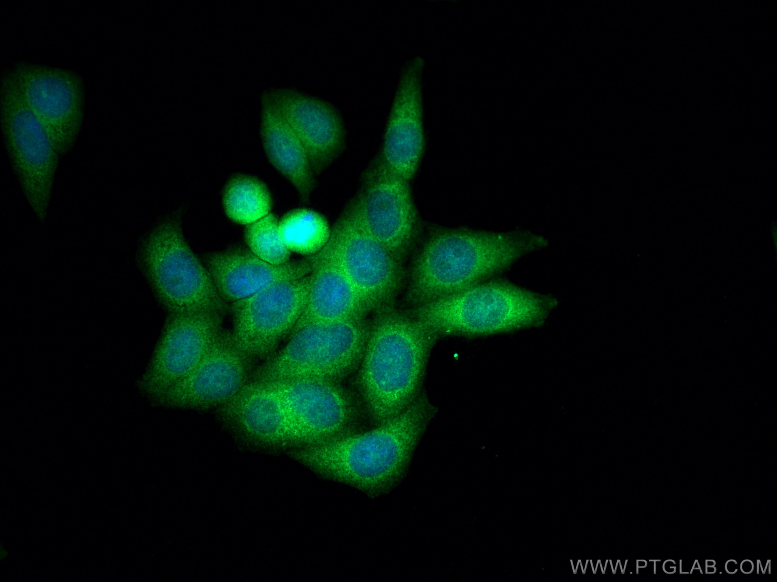 Immunofluorescence (IF) / fluorescent staining of HepG2 cells using CHMP4B Polyclonal antibody (13683-1-AP)