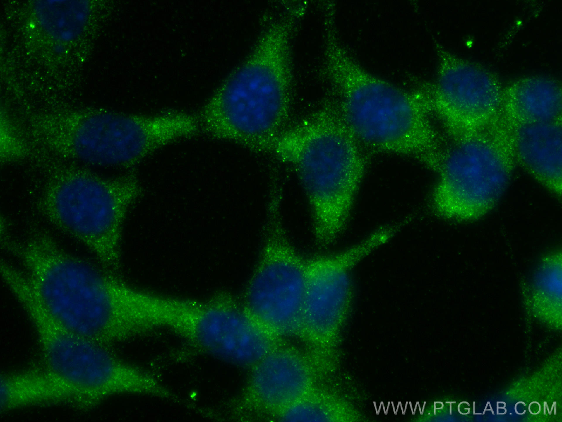 Immunofluorescence (IF) / fluorescent staining of NIH/3T3 cells using CHMP4B Polyclonal antibody (13683-1-AP)