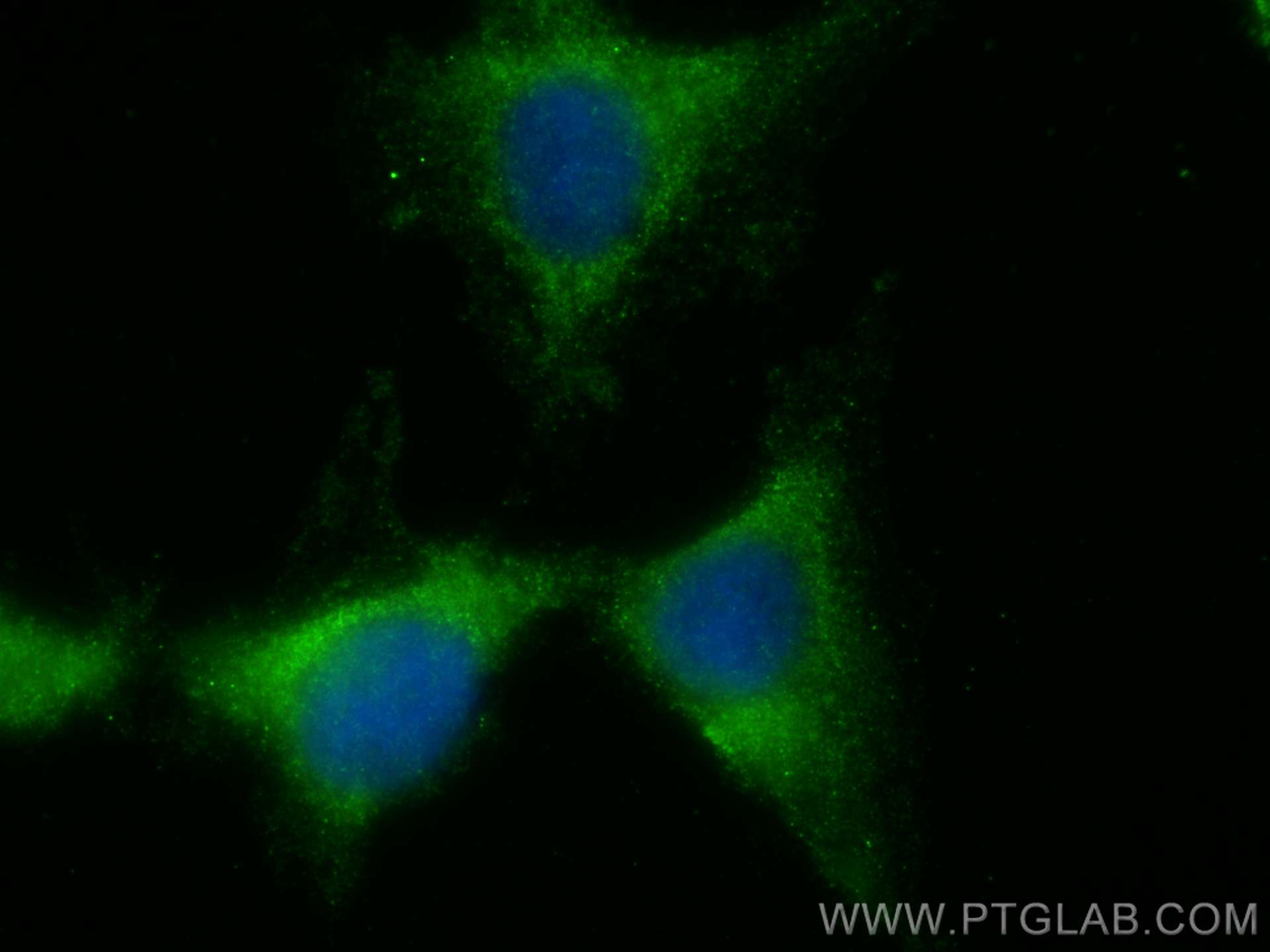 IF Staining of H9C2 using 13683-1-AP