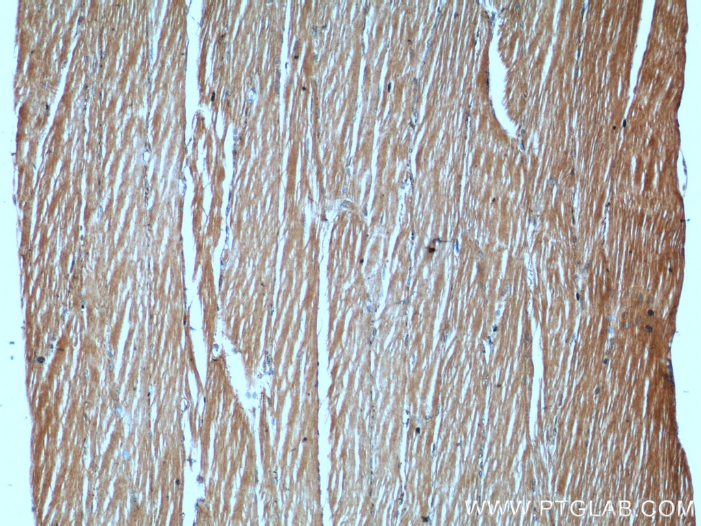 Immunohistochemistry (IHC) staining of human skeletal muscle tissue using CHMP4B Polyclonal antibody (13683-1-AP)