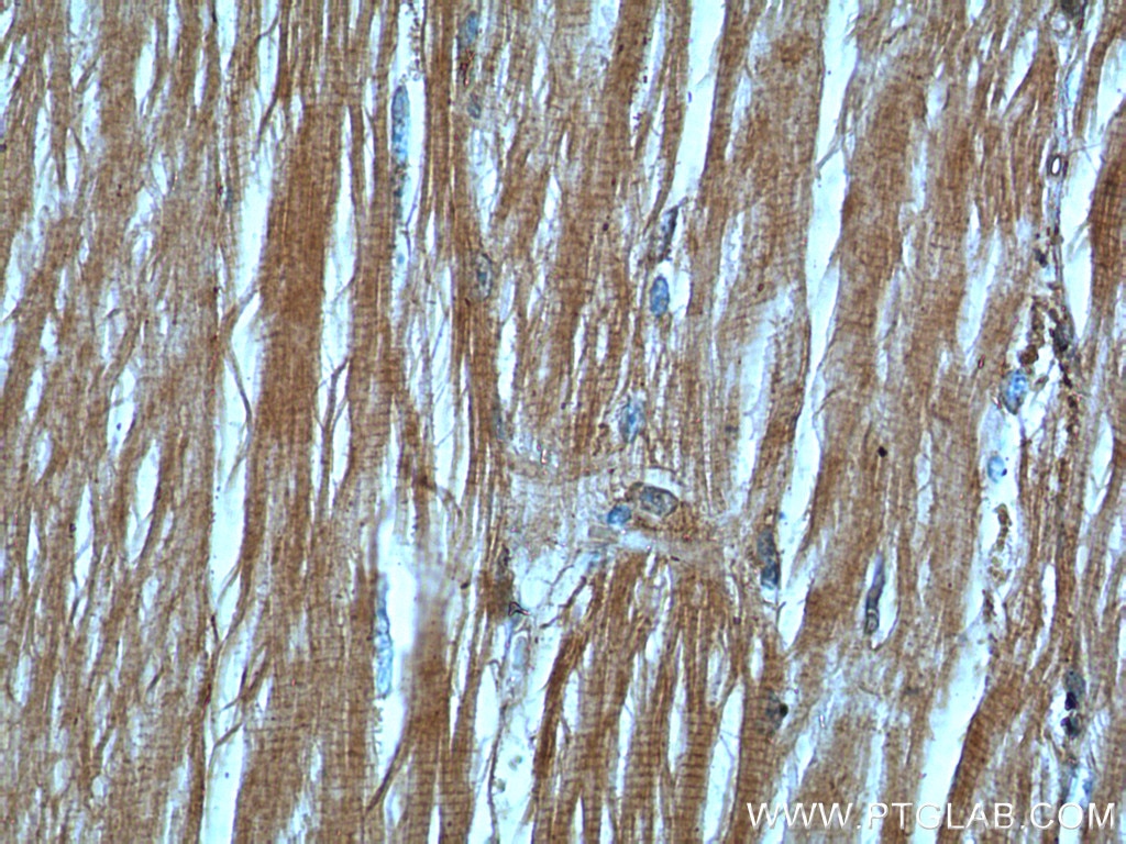 Immunohistochemistry (IHC) staining of human skeletal muscle tissue using CHMP4B Polyclonal antibody (13683-1-AP)