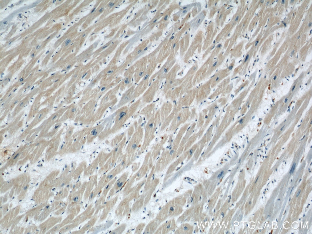 Immunohistochemistry (IHC) staining of human heart tissue using CHMP4B Polyclonal antibody (13683-1-AP)