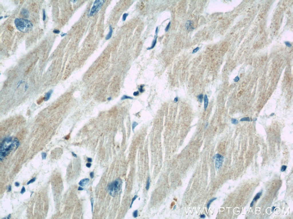 IHC staining of human heart using 13683-1-AP