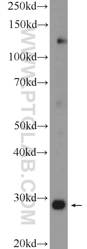 WB analysis of rat heart using 13683-1-AP