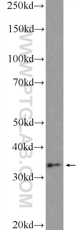 Western Blot (WB) analysis of HeLa cells using CHMP4B Polyclonal antibody (13683-1-AP)