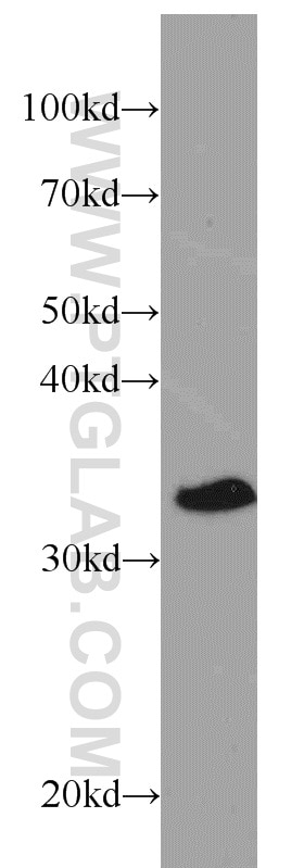 WB analysis of mouse heart using 13683-1-AP