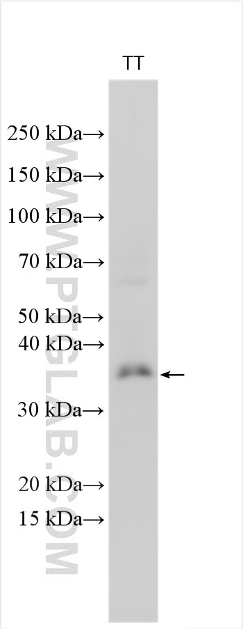 Western Blot (WB) analysis of various lysates using CHMP4C Polyclonal antibody (16256-1-AP)
