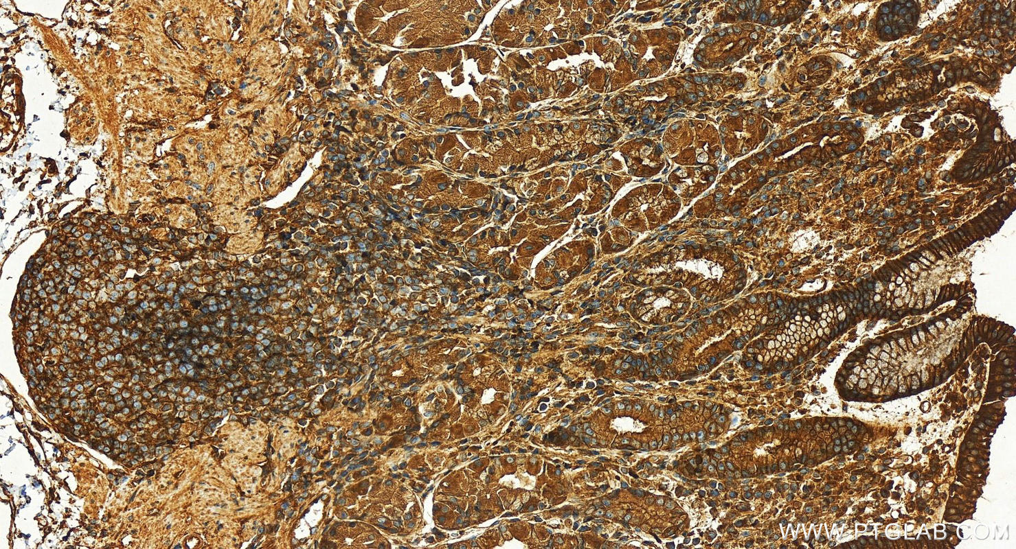 Immunohistochemistry (IHC) staining of human stomach tissue using CHMP6 Polyclonal antibody (16278-1-AP)