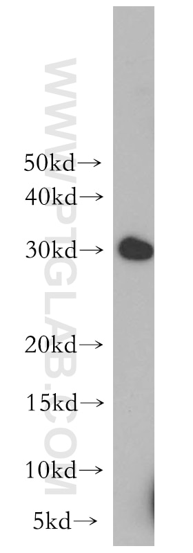 Western Blot (WB) analysis of A431 cells using CHMP6 Polyclonal antibody (16278-1-AP)