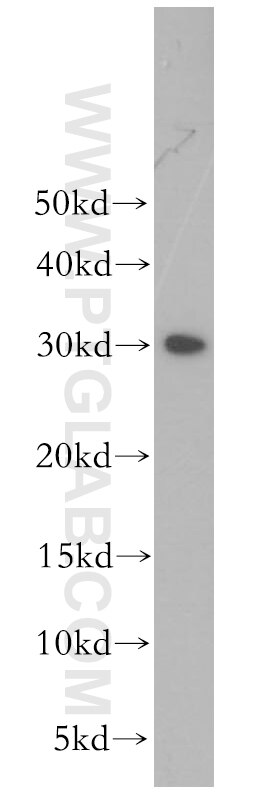 Western Blot (WB) analysis of A375 cells using CHMP6 Polyclonal antibody (16278-1-AP)