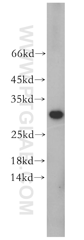 Western Blot (WB) analysis of mouse testis tissue using CHMP6 Polyclonal antibody (16278-1-AP)