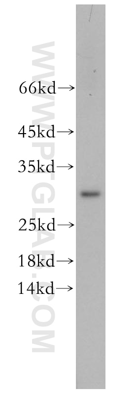 Western Blot (WB) analysis of Jurkat cells using CHMP6 Polyclonal antibody (16278-1-AP)