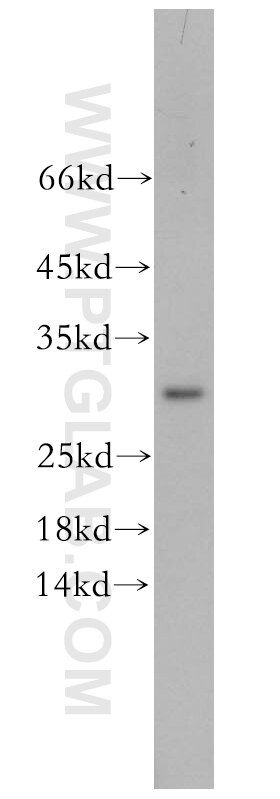 WB analysis of Jurkat using 16278-1-AP