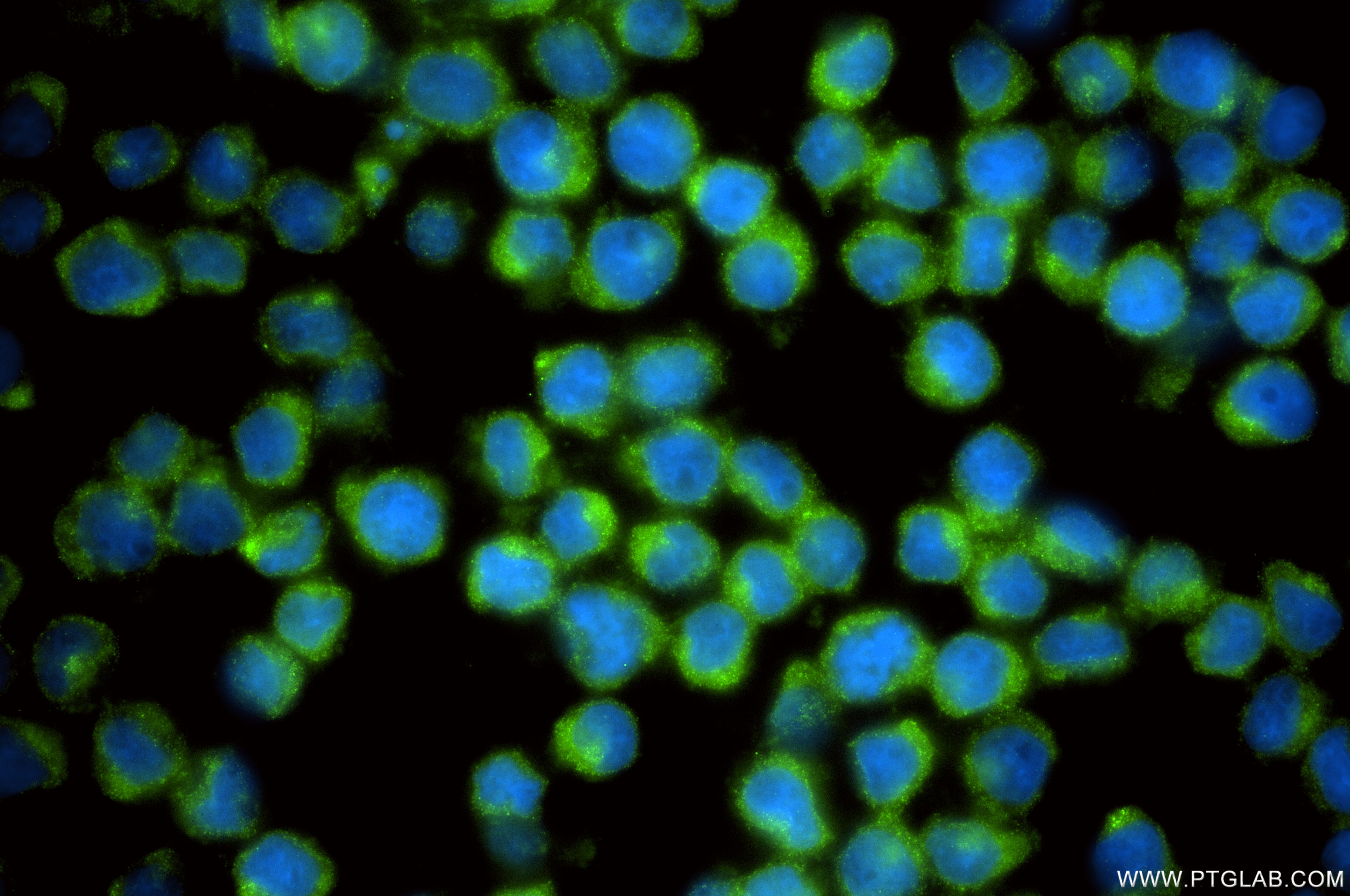 Immunofluorescence (IF) / fluorescent staining of U-937 cells using CHMP6 Recombinant monoclonal antibody (86474-3-RR)
