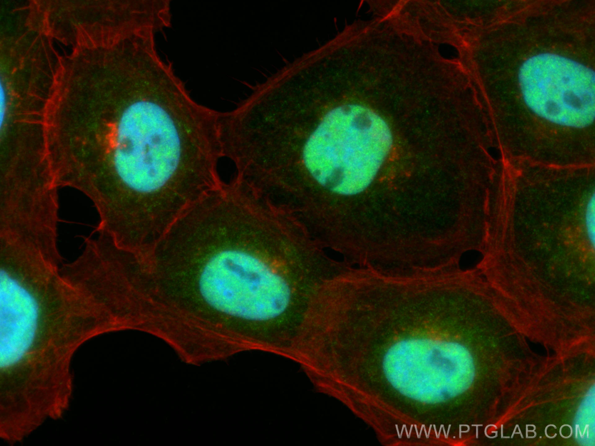 IF Staining of A431 using 16424-1-AP