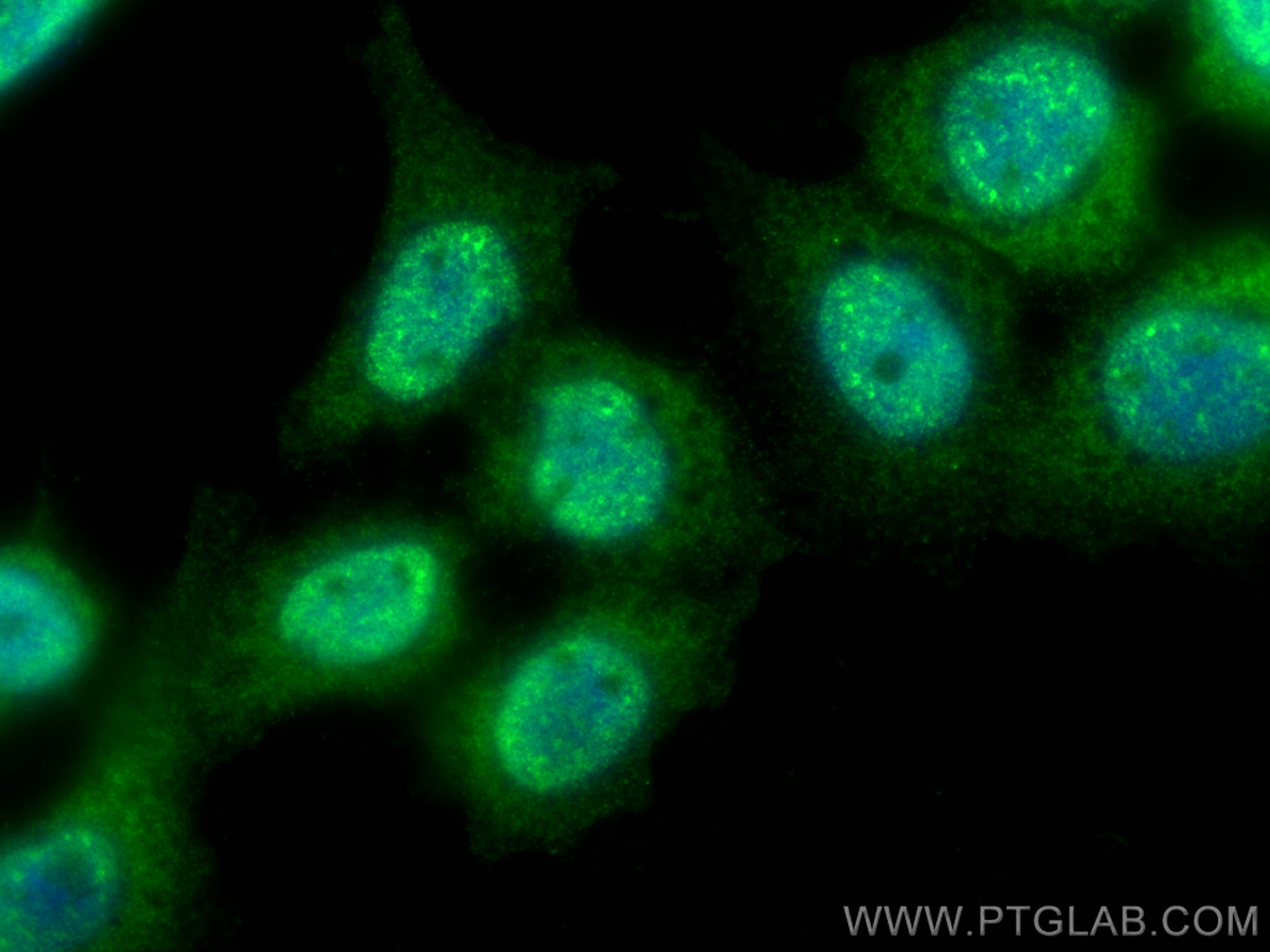 Immunofluorescence (IF) / fluorescent staining of A431 cells using CHMP7 Polyclonal antibody (16424-1-AP)