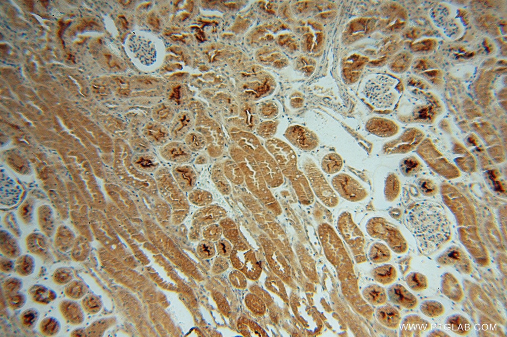 Immunohistochemistry (IHC) staining of human kidney tissue using CHMP7 Polyclonal antibody (16424-1-AP)
